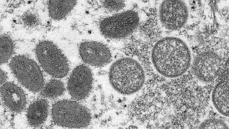 Philippines Reports More Monkeypox Cases; Africa CDC Warns Of New Challenges  - | Phot: UN News